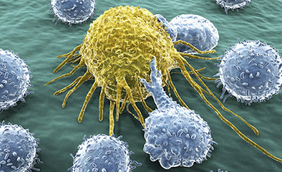 H ανοσο-ογκολογία φέρνει νέα δεδομένα  στη μάχη κατά του καρκίνου